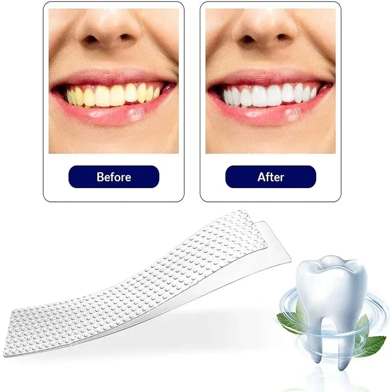 5D White Teeth Whitening Strips Professional Effects